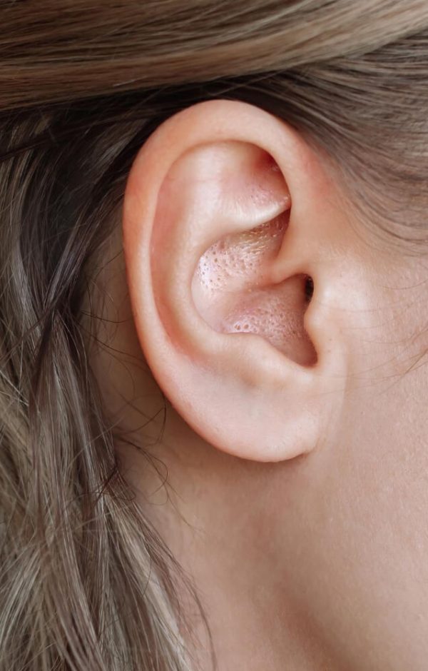 blackheads from the ear